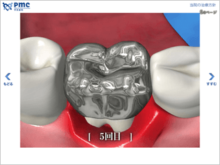歯のライフサイクル3D動画
