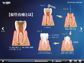 再発率の高い根幹治療