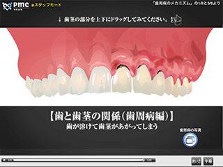 解説：歯と歯茎の関係