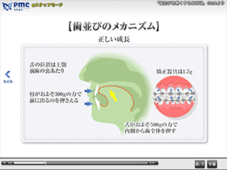 歯並びのメカニズム